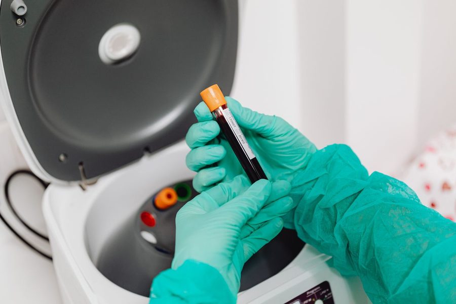Gloved hands holding a tube of drawn blood beside an open laboratory centrifuge
