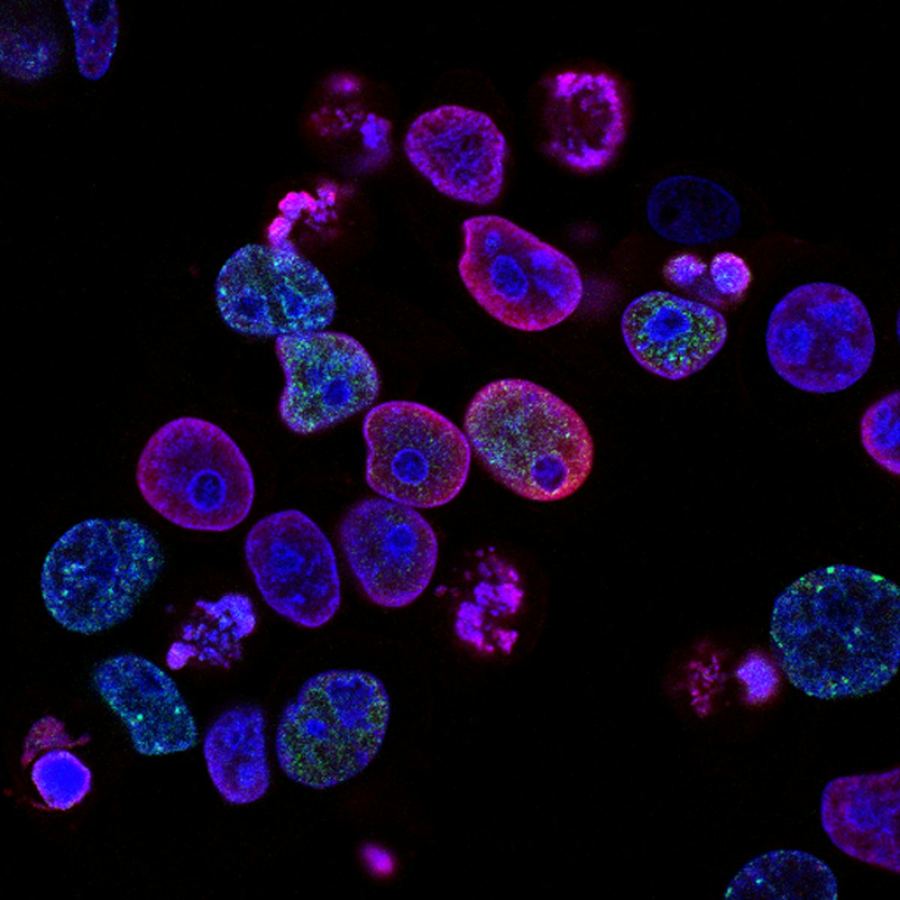 Exosome Therapy